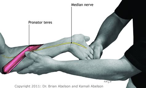 pronator compression test|pronator teres and median nerve.